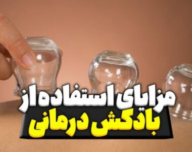 مزایای استفاده از بادکش درمانی