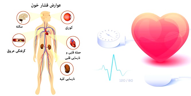 ۱۲ توصیه طلایی برای کنترل فشار خون