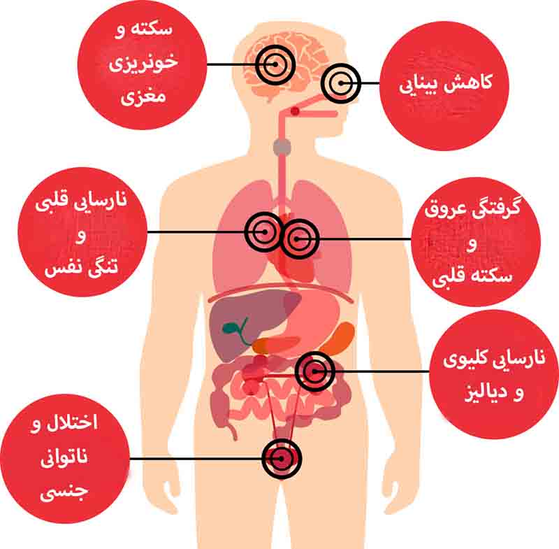۱۲ توصیه طلایی برای کنترل فشار خون