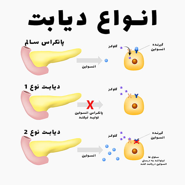 دیابت و چالش‌های نداشتن دستگاه قند خون